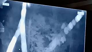 AMS event #6872-2025 caught from Attalla US