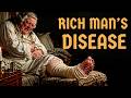 Inside a Georgian Gentleman's Body After Twenty Years of Good Living | History for Sleep