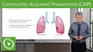 Community Acquired Pneumonia (CAP) – Pediatrics | Lecturio