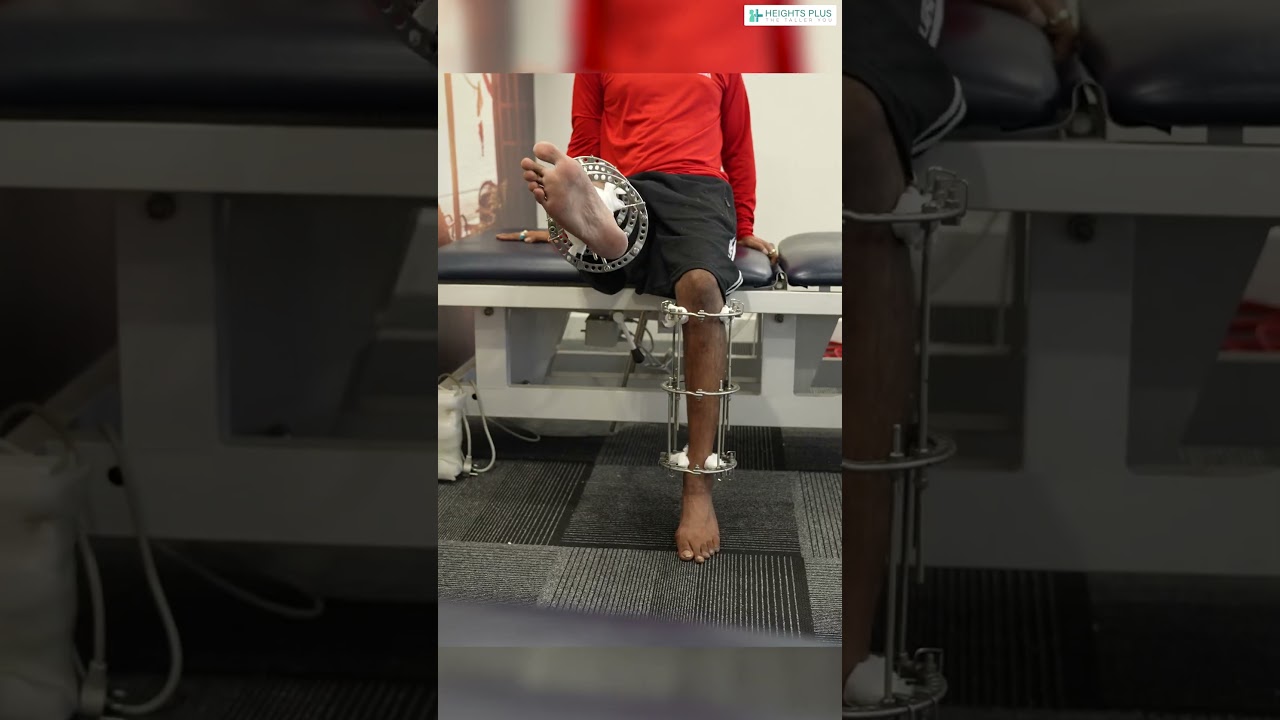 How to Recover Faster After Height Increase Surgery