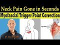 Neck Pain Gone In Seconds Self Help Myofascial Trigger Point Correction Dr Alan Mandell DC