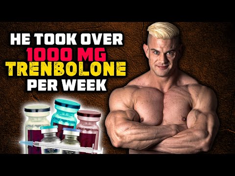He Took Over 1000 Mg Trenbolone Per Week And This Is What Happened...