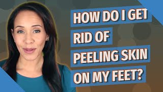 How do I get rid of peeling skin on my feet?