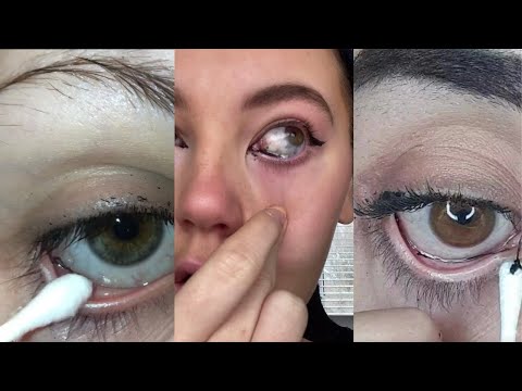 Super Satisfying EYE String Removal🤯- TikTok Compilation