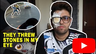 I LOST MY EYE 😢 WHILE RIDING MY BIKE || ROAD RAGE 😡 || TEMPORARY EYESIGHT LOSS