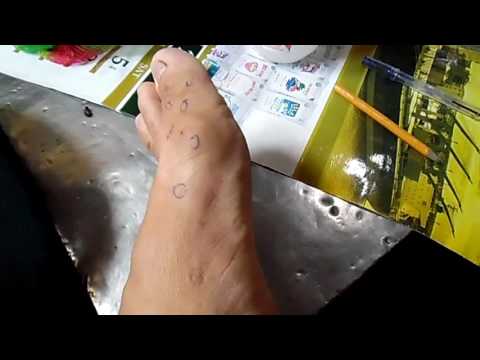 Katawan halamang-singaw lunas Fir langis mula sa mga halamang-singaw ng paa