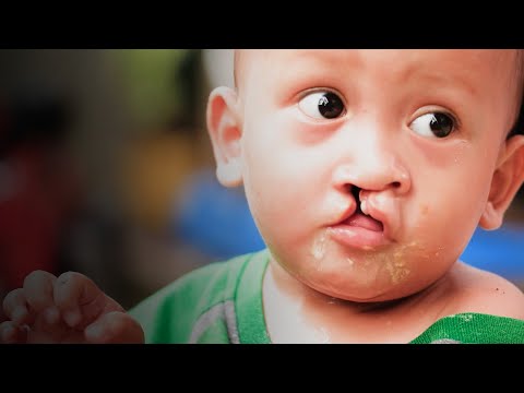 Your Love Gave a Child a Chance at a Normal Life