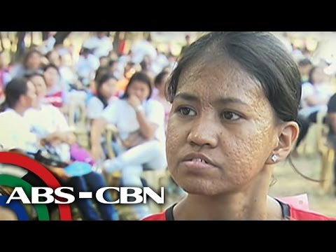 Pine karayom para sa pagbaba ng timbang Pagbaba ng timbang cereal diyeta menu