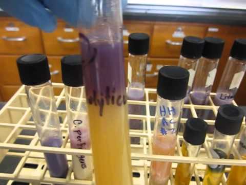 Micro Lab:  Litmus Milk demo:  C. perfringens