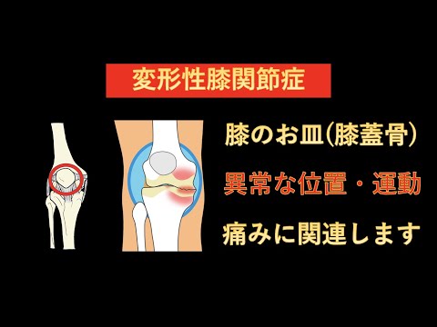 膝蓋骨 (属)について詳しく解説
