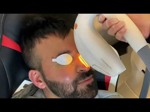 Dry eye treatment: Intense Pulsed-Light (IPL) Therapy