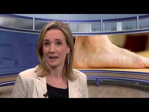 "Plattfuss" - Hirslanden & Tele M1: Gesundheitssendung CheckUp