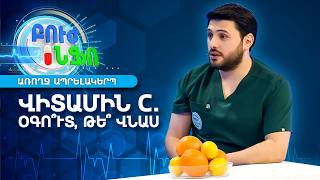 Առողջ ապրելակերպ/Վիտամին C․ Որտե՞ղ կարող եք ստանալ, ինչ դեր ունի առողջության համար