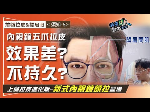 前額拉皮&提眉眼<須知-5>內視鏡上額拉皮再進化! 改良傳統五爪前額內視鏡拉皮缺點 抬頭紋/皺眉紋/眉眼下垂/M型禿 一次搞定!