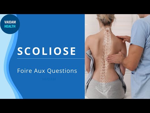 SCOLIOSE
