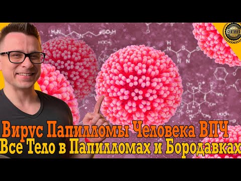 Все тело в бородавках и папилломах! Что делать с ВПЧ?! Все тело в бородавках и папилломах! Что делать с ВПЧ?!