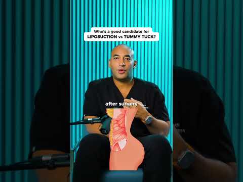 Liposuction vs Tummy Tuck