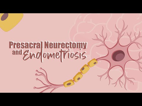 Presacral Neurectomy and Endometriosis