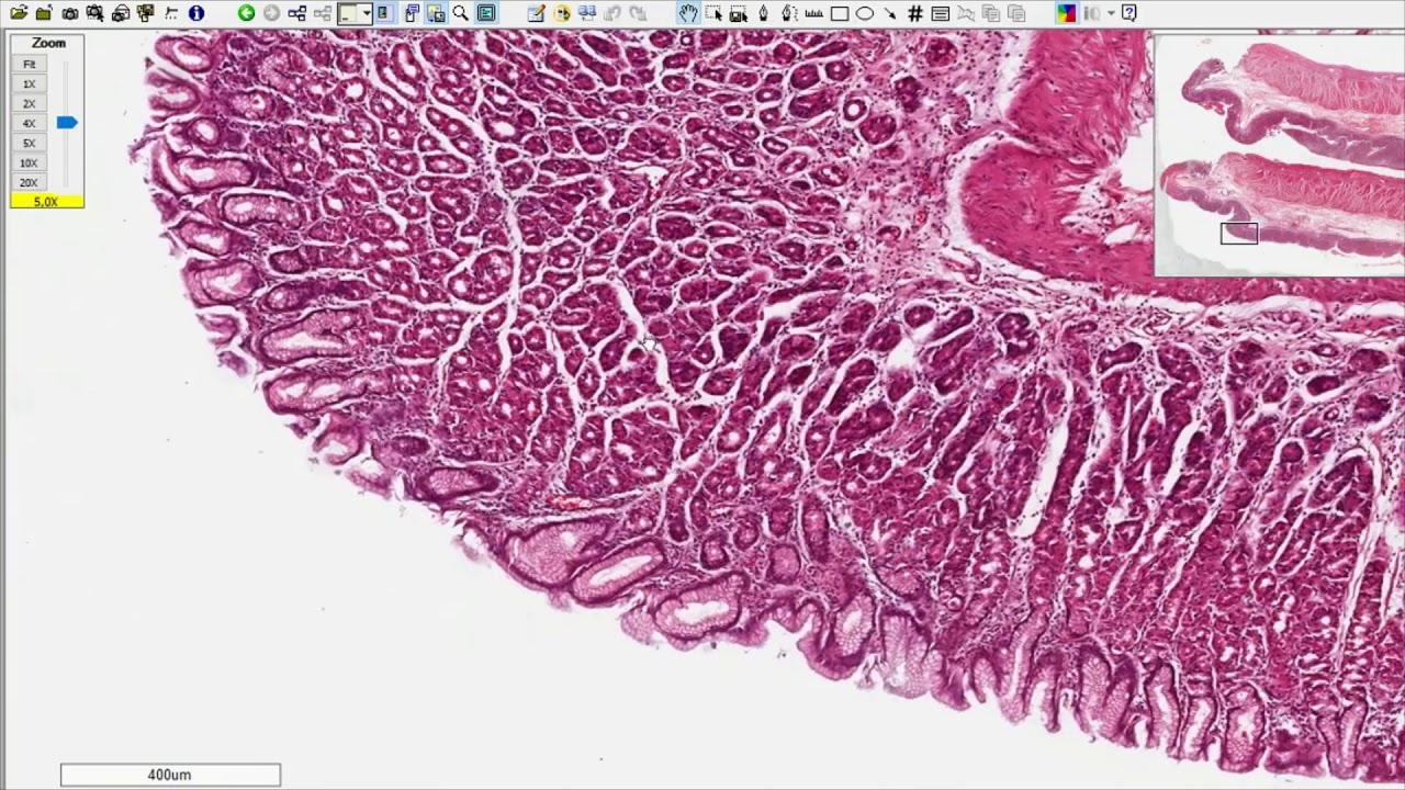 [SISTEMA DIGESTÓRIO] Explorando lâmina histológica de estômago (fundo e corpo)