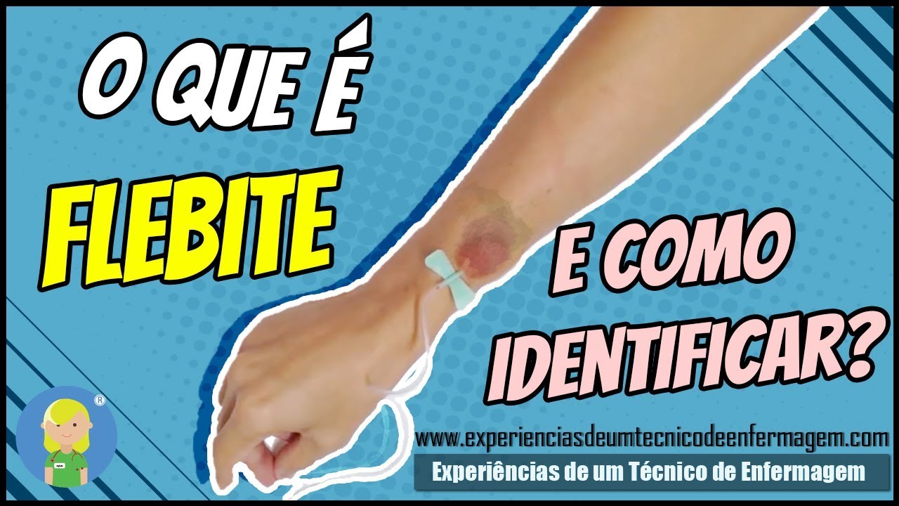 O Que é Flebite e como identificar ?