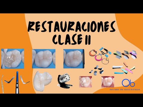 Restauraciones Clase II 🦷