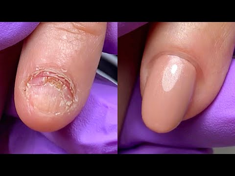 NO HAY UÑA 😱| UÑAS MORDIDAS | trabajo con Polygel ❤️