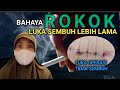 DAMPAK ROKOK BAGI KESEMBUHAN LUKA OPERASI