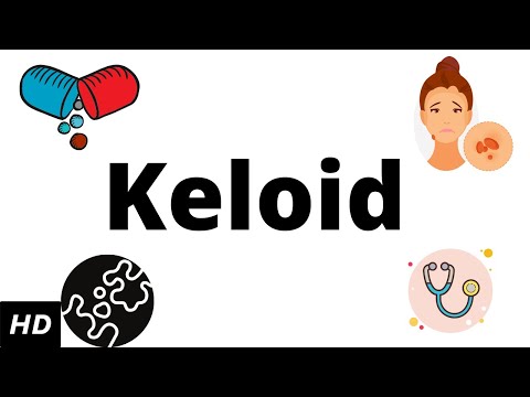 Keloid, Causes, Signs and Symptoms, Diagnosis and Treatment.