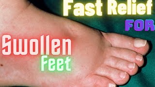Swollen Feet ? Causes and Remedies.