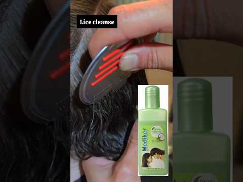 Mediker anti lice treatment shampoo | lice treatment #liceremoval #licetreatment #licecomb #haircare