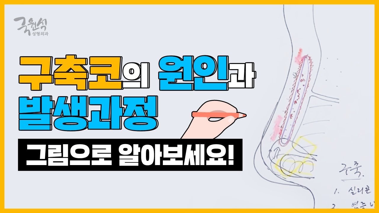 구축코의 원인과 발생과정. (Causes and Developing process of Contracted Nose)