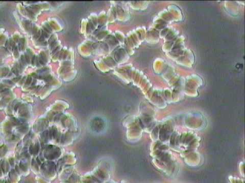 CCC0170025 @2017.06.23 before treatment