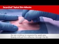SecureSeal® Topical Skin Adhesive | Cardinal Health