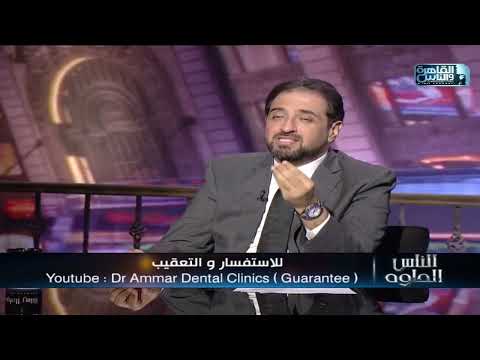 مقابلة — زراعة الأسنان