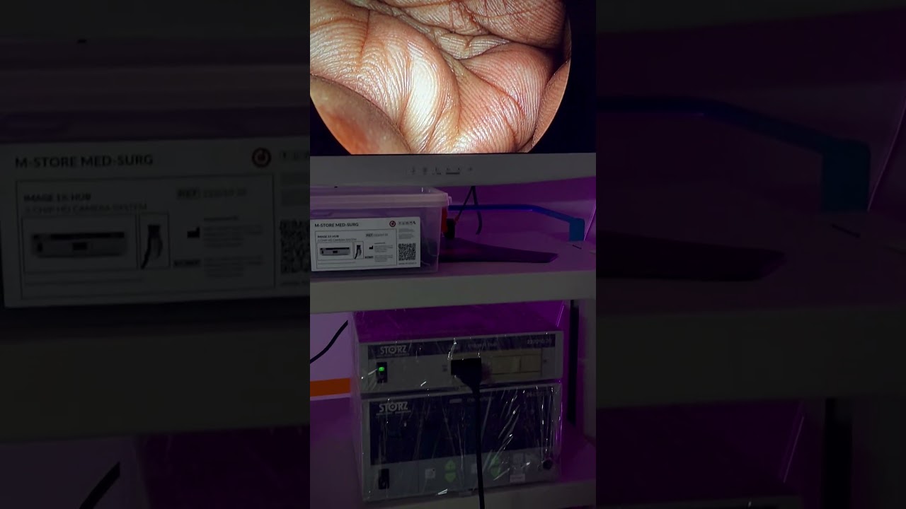 Karl Storz Image 1 HUB HD, H3Z Head
