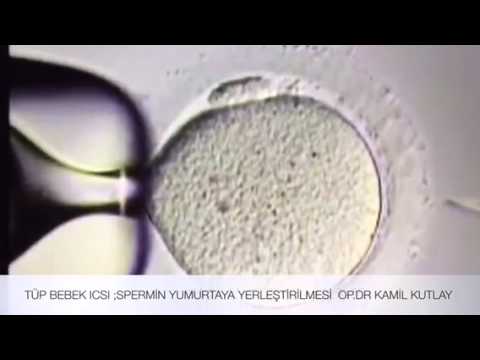 Tüp Bebek "ICSİ" Uygulaması