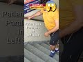 Paralysis Kya Hota Hai Shorts Physiodrdeepaksoni Hemiplegia