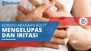 Eksem, Penyakit Kulit akibat Tidak Bisa Memperbaiki Sel yang Rusak, Kulit Mengelupas, dan Iritasi
