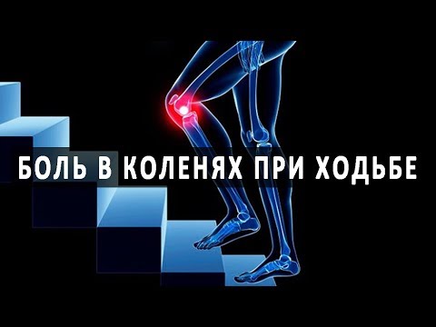 Замена тазобедренных суставов иркутск Первоначальные признаки шейного остеохондроза