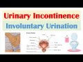 Urinary Incontinence Stress Urge Overflow Functional Causes Symptoms Diagnosis Treatment