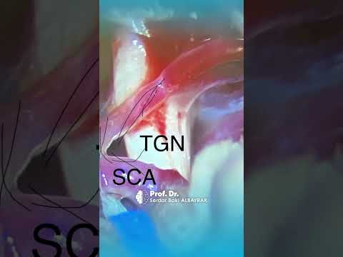 MVD Video