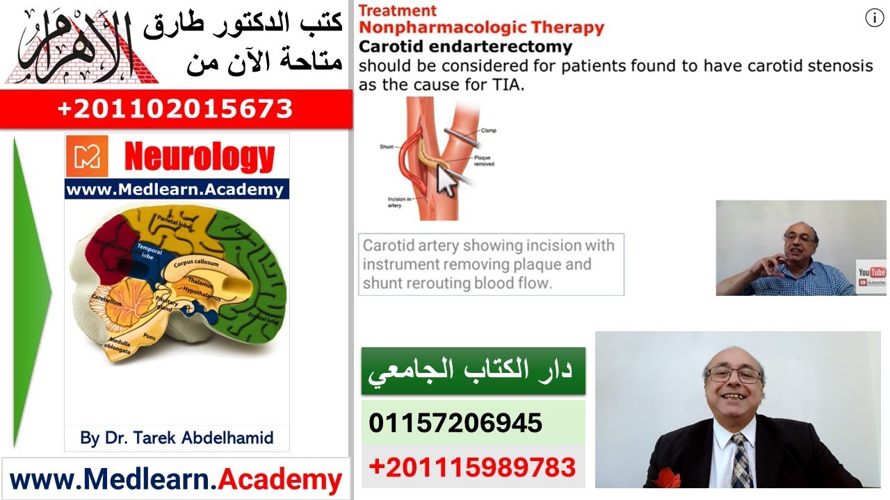 Transient Ischemic Attacks TIA (Part 3)