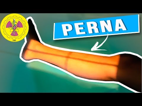 POSITIONING: ROUTINE LEG