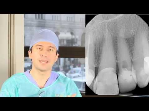 Dystrophic Calcification - YouTube