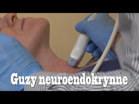 Dziecko 2 lata deformacji stóp Zniekształcenie palców, gdy kości na zdjęciu nogi