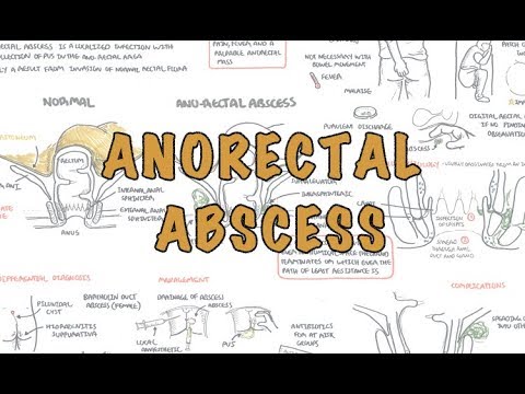 Anorectal Abscess (General Surgery) - Overview