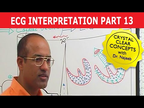 EKG or ECG Interpretation | Part 13/20