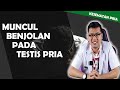 BUAH ZAKAR BENGKAK SEBELAH DOKTER SADDAM ISMAIL
