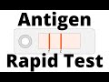 How SARS CoV2 Antigen Rapid Tests Work Covid 19 Testing