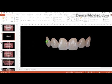 Digital Smile Design - Part 4/4. Кочман Кристиан